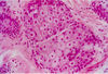 Filename=sebaceous_gland.jpg
Filesize=573KiB
Dimensions=878x600
Date added=Aug 28, 2007 sebaceous_gland.jpg