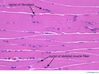 skeletalmusclelongitudinalsection40x.jpg