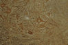 Filename=spinalcord6.jpg
Filesize=29KiB
Dimensions=400x267
Date added=Sep 07, 2007 spinalcord6.jpg