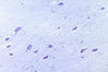 Filename=spinalcord8.jpg
Filesize=25KiB
Dimensions=400x267
Date added=Sep 07, 2007 spinalcord8.jpg