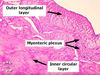 stomachganglion1-2f1.jpg