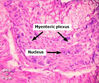 stomachganglion1-2f2.jpg