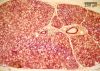 Filename=sublingual10X.jpg
Filesize=404KiB
Dimensions=800x574
Date added=Apr 27, 2009 sublingual10X.jpg