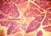 Filename=submandibular4X_lbl.jpg
Filesize=441KiB
Dimensions=800x579
Date added=Apr 27, 2009 submandibular4X_lbl.jpg
