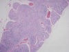 thymus5.jpg