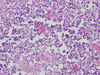 thymus8.jpg