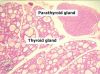 thyroid2F.jpg