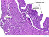 urinarybladder40x.jpg