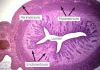 Filename=uterus1~0.jpg
Filesize=120KB
Dimensions=396x281
Date added=Aug 27, 2008 uterus1~0.jpg