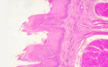 histology slide