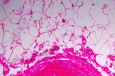 histology slide