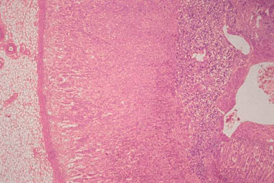 histology slide