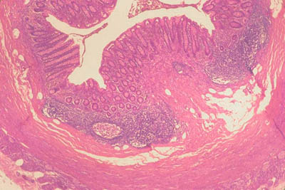 histology slide of bone