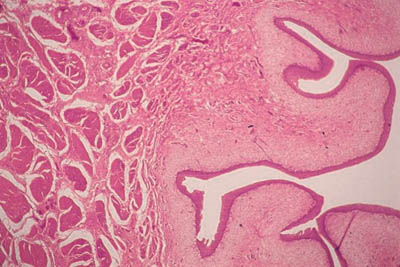 histology slide