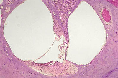 histology slide