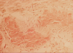 histology slide