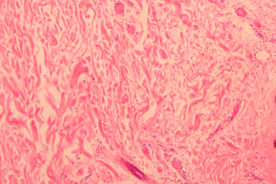 histology slide