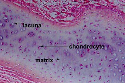 histology of hyaline