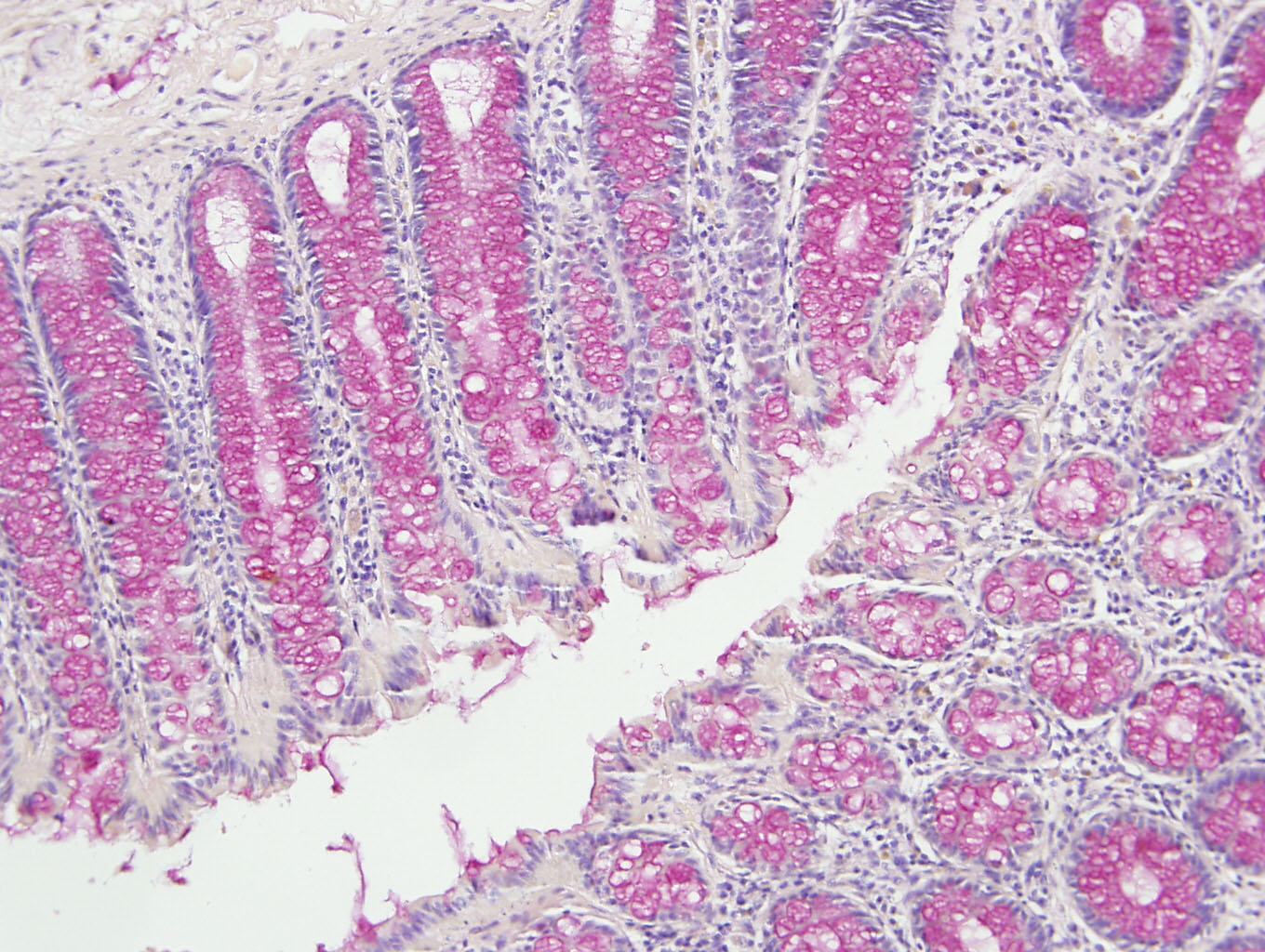 histology slide