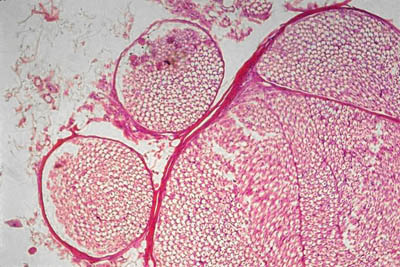 histology slide