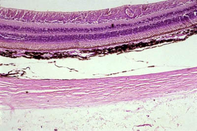 histology slide