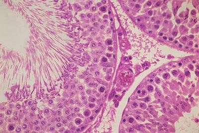 histology slide