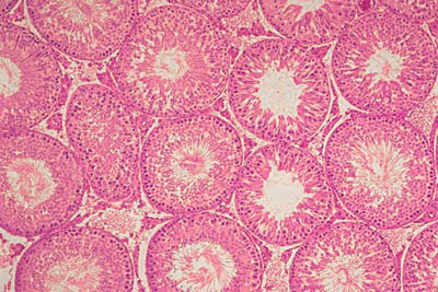 histology slide