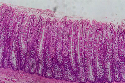 histology slide