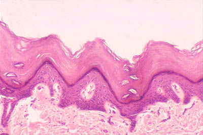 histology slide