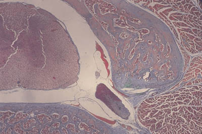 histology slide