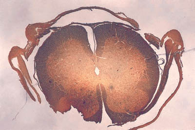 histology slide