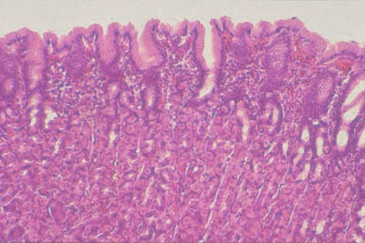 histology slide