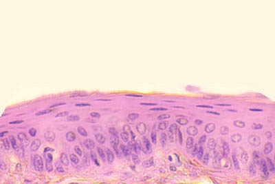 histology slide