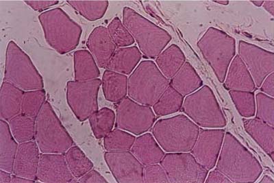 histology slide