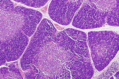 thymus gland slide