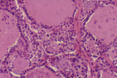 histology slide