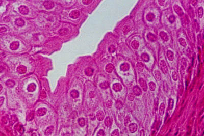 histology slide