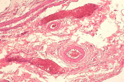 histology slide