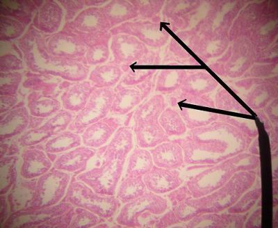 Testes - histology slide
This is a histology slide of the testis. The pointer is on Leydig cells.

Original image by Jpogi at English Wikipedia, via Wikimedia Commons. Public domain.

Changes were made to the original image. 

