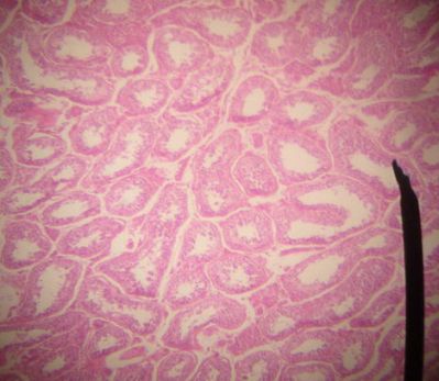 Testes - histology slide
This is a histology slide of the testes.

Original image by Jpogi at Wikipedia, via Wikimedia Commons. Public domain.

Changes were made to the original image.

