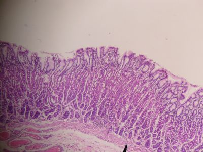 Stomach - histology slide
This is a histology slide of the stomach.

Image by Jpogi at Wikipedia, via Wikimedia Commons. Public domain.

No changes were made to the original image downloaded (note: this version was downloaded at reduced resolution from Wikimedia Commons).

