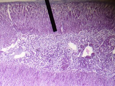 Adrenal gland - histology slide
This is a histology slide of the adrenal gland. The pointer is on the zona reticularis of the adrenal cortex.

Image by Jpogi, via Wikimedia Commons. Public domain.

No changes were made to the original image downloaded (note: this version was downloaded at reduced resolution from Wikimedia Commons).

