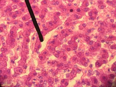 Liver - histology slide
This is a histology slide of the liver. The pointer is on a sinusoid.

Image by Jpogi at Wikipedia, via Wikimedia Commons. Public domain.

No changes were made to the original image downloaded (note: this version was downloaded at reduced resolution from Wikimedia Commons).

