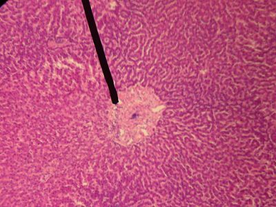 Liver - histology slide
This is a histology slide of the liver. The pointer is on the central vein.

Image by Jpogi at English Wikipedia, via Wikimedia Commons. Public domain.

No changes were made to the original image downloaded (note: this version was downloaded at reduced resolution from Wikimedia Commons).

