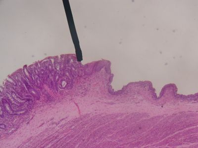 Recto-anal junction -histology slide
This is a histology slide of the recto-anal junction.

Image by Jpogi at Wikipedia, via Wikimedia Commons. Public domain.

No changes were made to the original image downloaded (note: this version was downloaded at reduced resolution from Wikimedia Commons).
