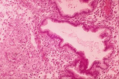 Uterus Histology - Endometrium - histology slide