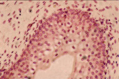 histology of bladder