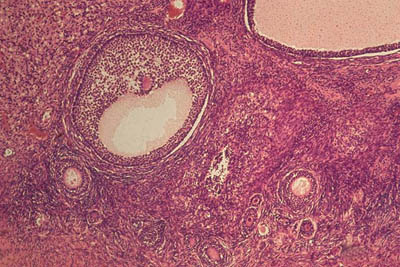 histology slide