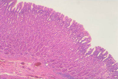 histology slide